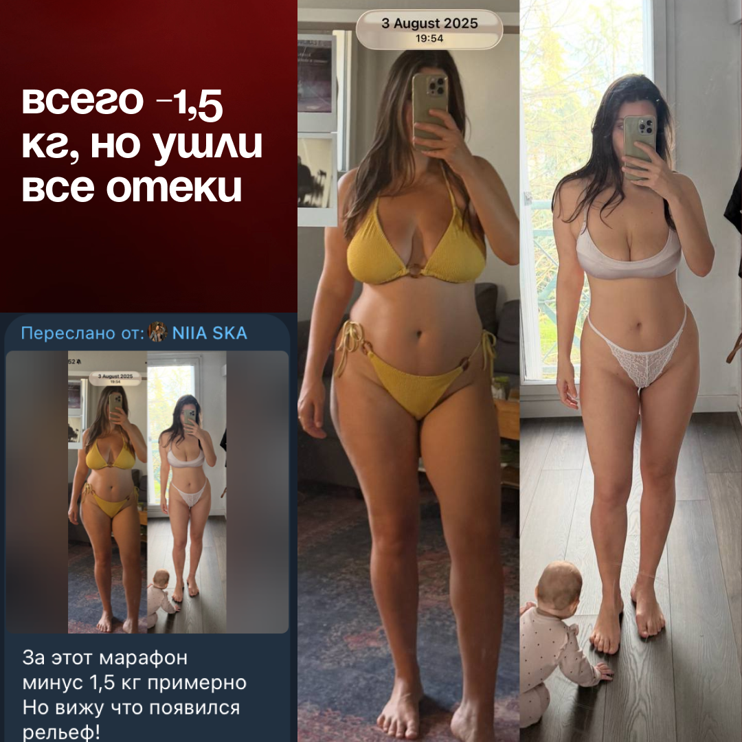 Результат участницы — ушли отёки